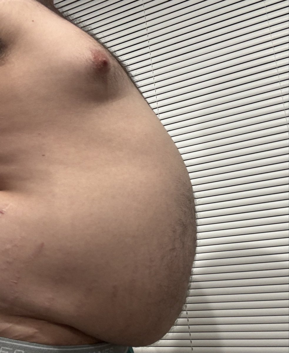 Mortalcorn600's tweet photo. I took some advice, did a few things, and ended up with the largest inflation I’ve done to date. 🥵🥵 I can’t bend or breath. #bellyinflation #bellyexpansion #airinflation #belly https://t.co/l48ZK9lJgV