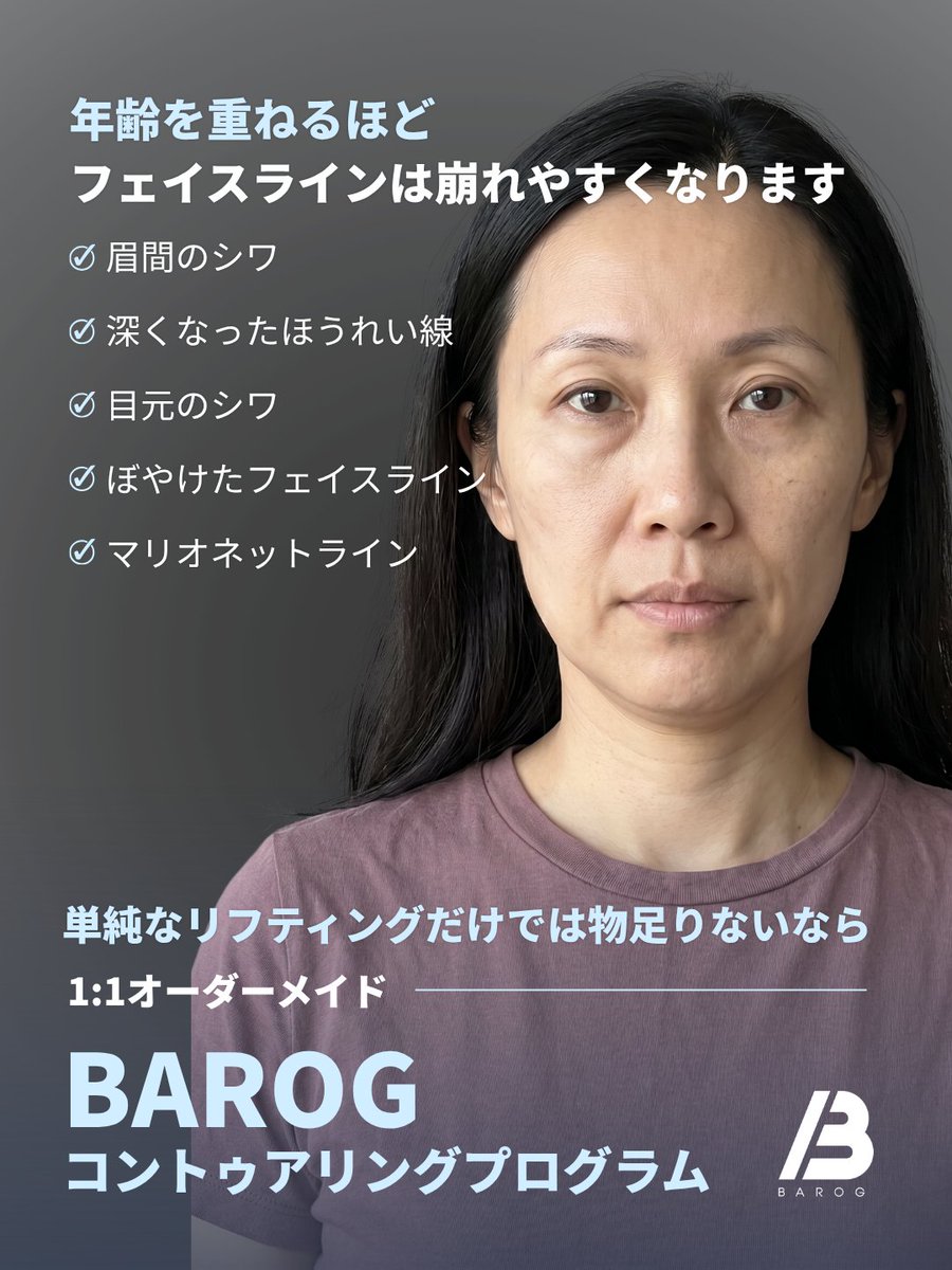 barog_jp's tweet photo. 1:1オーダーメイド
BAROGコントゥアリングプログラム✨

コラーゲン生成
＋肌の支持力強化

年齢を重ねるほど、
フェイスラインは少しずつ崩れていきます。

☑ 眉間のシワ
☑ 深くなるほうれい線
☑ 目元のシワ
☑ ぼやけたフェイスライン
☑ マリオネットライン

ただ引き上げるだけの
単純なリフティングではなく、

“支える力”まで整える
新しい輪郭ケアへ。

BAROGコントゥアリングプログラムは、
一人ひとり異なる
たるみ・ボリューム・輪郭バランスを分析し、
1:1でオーダーメイドデザインします🤍

🗣 日本語相談可能
🔍 LINE ID : barog_jp