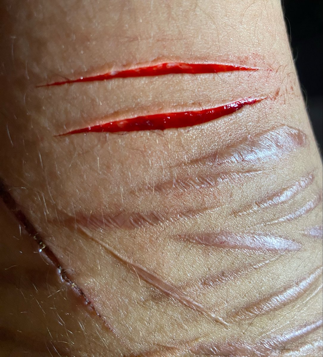 milkbonebites89's tweet photo. irl is now disordered n making me feel very aware of how fat and gross i am

he keeps talking abr how disgusting fat ppl are and telling me basic disordered weight loss tips that i already know cuz ive already been through ts 

cuts https://t.co/BE7ERSmnZJ