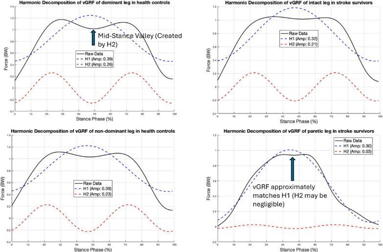 ExpPhysiol's tweet photo. Li Zhang, Hongfang Yao, Shuisheng Fu and Jung Hung Chien (The First Affiliated Hospital of Guangxi Medical University) examine harmonic and power spectrum analysis of vertical ground reaction force in patients who have a stroke within 3 months 

📖 https://t.co/ttawruyUDZ https://t.co/9bbk1ssGVQ