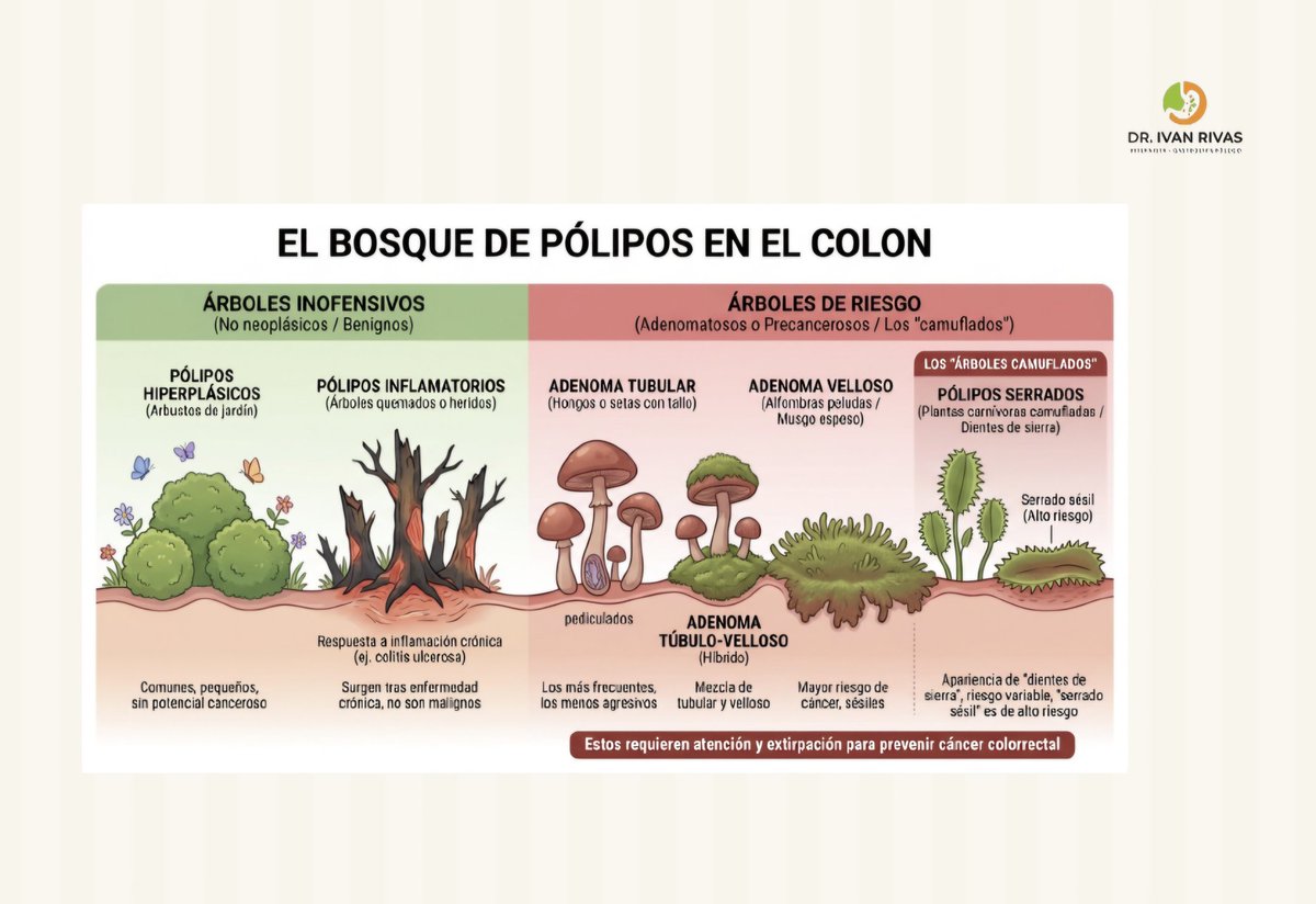 Ivanri's tweet photo. Polipos benignos y malignos
https://t.co/gSjcb9rhhO https://t.co/vzEuTnQ495