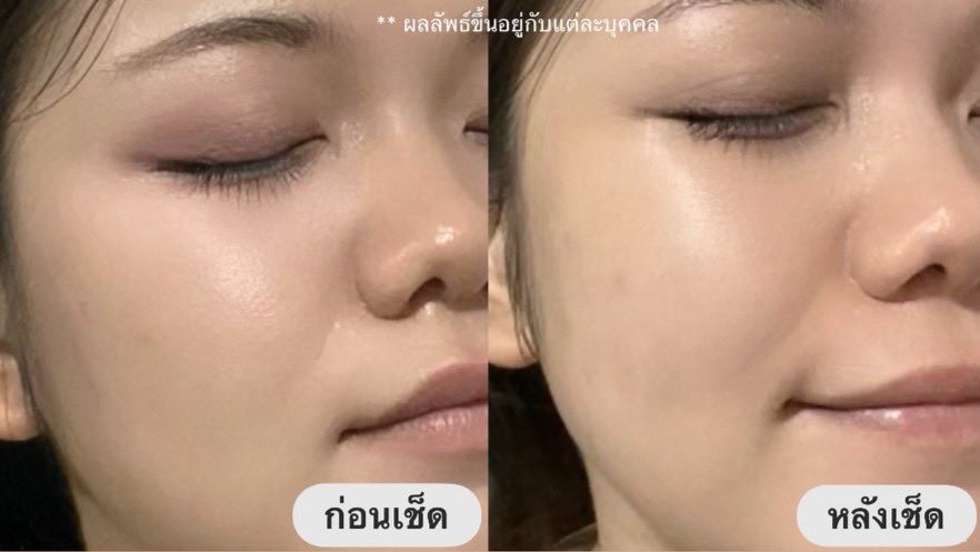 privmeime_'s tweet photo. ลบเมคอัพ+บำรุง ยกให้นีเวียไมเซล่าขวดเขียวมีเซรั่ม 5% เช็ดเมคอัพกันน้ำออกหมด ไม่เหนียวเหนอะ ไม่อุดตัน ไม่ทิ้งความมันบนผิวเลย ใช้ไปเรื่อยๆสิวลดด้วย เริ่ดเลยล่ะ ใครสายแต่งหน้าจัดแล้วกลัวสิวขึ้น แนะนำขวดนี้เลย
#สิว #รอยสิว #ใช้เองรีวิวจริง #รีวิวบิวตี้ #ใช้จริงรีวิวจริง https://t.co/Hdr7jkOZLU