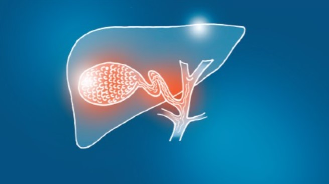 OncologyTimes's tweet photo. For patients with malignant #BiliaryObstruction, endoscopic ultrasound-guided choledochoduodenostomy is a potentially safer alternative to endoscopic retrograde cholangiopancreatography for establishing biliary drainage. https://t.co/dPXekQnjcP https://t.co/NvFDyF6mCp