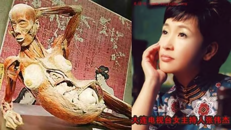 Awakend_Citizen's tweet photo. 1998年前後、中国・大連で一人の女性アナウンサーが姿を消した

名前は張偉傑

大連テレビの人気司会者だったとされ、当時、大連市長だった薄熙来との関係が噂された人物である

この話が異様な形で再燃したのは、数年後に世界各地で開催された人体標本展だった

展示されていたのは、胎児を宿した妊婦のプラスティネーション標本

「妊娠8か月の女性」
「大連で行方不明になった女性アナウンサー」
「大連市長・薄熙来との愛人関係」
「嫉妬した妻・谷開来」
「大連の人体標本工場」

この断片がつながり、ネット上では「あの標本は張偉傑ではないか」という噂が広がった

「未解決の失踪」と「人体標本」
極めて不穏な疑惑

だが、この話が単なる都市伝説で終わらないのは、人体標本展そのものに、現実の深い闇が存在するからだ

世界各地で開かれた人体標本展では、本物の人間の遺体が使われていた

水分や脂肪を樹脂に置き換え、腐敗しない標本にするプラスティネーション技術

問題は、その遺体が誰のものだったのか、本人は同意していたのか、家族は知っていたのか、誰も証明できなかったことだ

これは陰謀論ではない

ここから見えてくるのは、
死体が、その由来が不明のまま、商品になったという現実である

皮膚を剥がされ、筋肉を露出され、ポーズを取らされ、客の前に並べられる

生前の名前は消される
死因も消される
家族も消される
残るのは「標本」というラベルだけ

本人の同意もなく、国家権力や警察や業者の都合で標本にされた人間がいたかもしれない

日本でも「人体の不思議展」は大きな人気を集めた
僕も実際２回観に行った

だが後年、日本医師会の生命倫理懇談会は、この展示について「遺体の扱いにおいて人の尊厳に反し、倫理的に認められない」とする見解を示した

フランスでも、人体標本展が「遺体の尊厳を損なう」として閉鎖命令を受けた

スイス・ローザンヌでも、主催者が遺体の出所や本人・家族の同意を示せなかったため、展示が禁止された

張偉傑が本当にあの妊婦標本だったのかは分からない
しかし「分からないこと」が恐ろしい

「人体の不思議展」
本当に不思議だったのは、
あれだけ大量の人間の死体が棚に並べられていた事実そのものだ