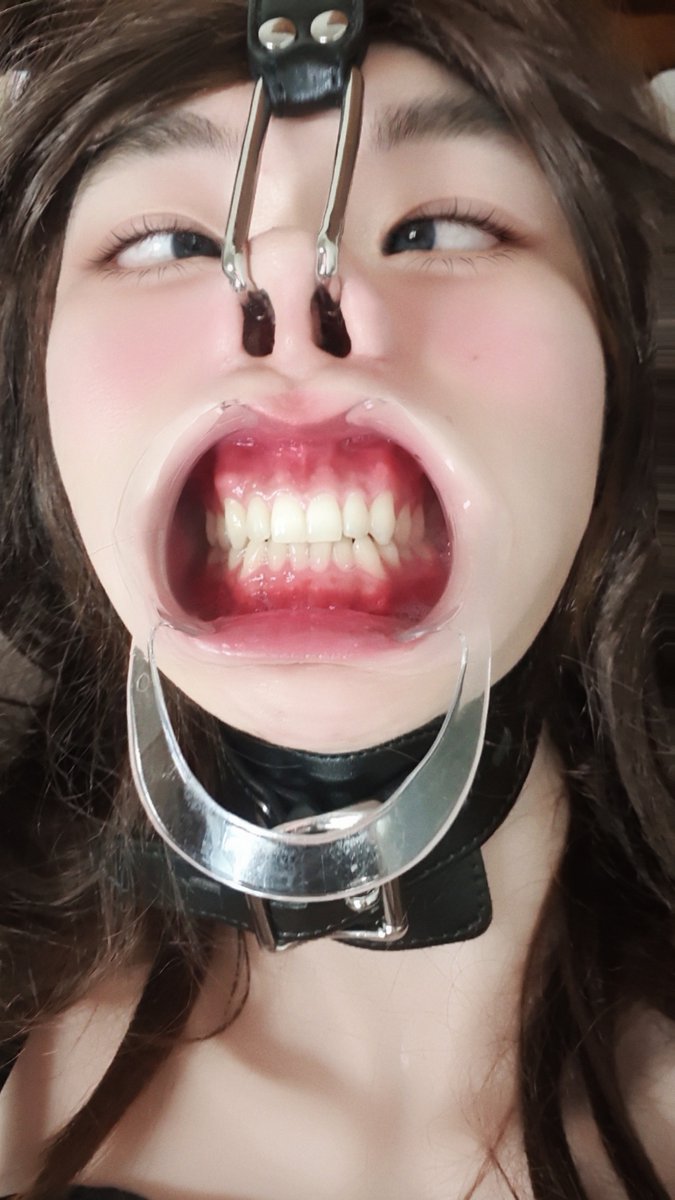 n0vhar3's tweet photo. 코 성형 해서 몇달 동안 노즈 후크 못 씀 ㅠㅠ (노즈 후크 쓸려고 일부로 자가늑 대신 귀 연골 씀 ㅋ) https://t.co/VmkUDr1LMY