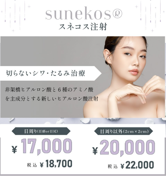 wbc_nagoya's tweet photo. 【SUNEKOS（スネコス）💎】
スネコスとは…
非架橋ヒアルロン酸＋6種類のアミノ酸を
特殊な比率で配合した
イタリア発の次世代エイジングケア製剤🇮🇹

💎こんなお悩みにおすすめ💎
✔ 目元の小ジワ・たるみ
✔ 目元のクマ
✔ 肌ツヤを良くしたい
✔ 肌の弾力アップ
✔ 毛穴の開き
✔ 手の甲のシワ
✔ 首のシワ
小ジワ改善だけでなく、お肌のハリ・ツヤもUP✨
自らの肌再生を促し、急激ではなく
“自然に若返る”治療です☺️💞
#スネコス #SUNEKOS #アンチエイジング #美肌治療 #エイジングケア