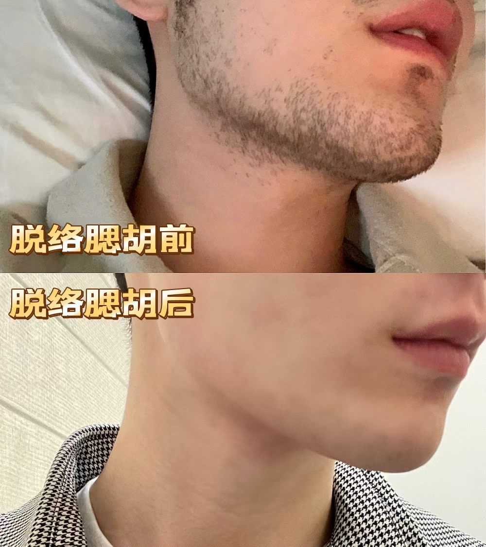 vx17802726392's tweet photo. 别再说男人糙点没关系，脱不脱毛，颜值差距直接拉满！男士专属脱毛，一键切换清爽型男模式 喜欢脱毛的可以预约了 工作室在汉口江汉路 来不了武汉的可以推荐给当地的师傅做 全国各地都有工作室 主页里面有联系方式 欢迎咨询 https://t.co/XPZw95dFQq