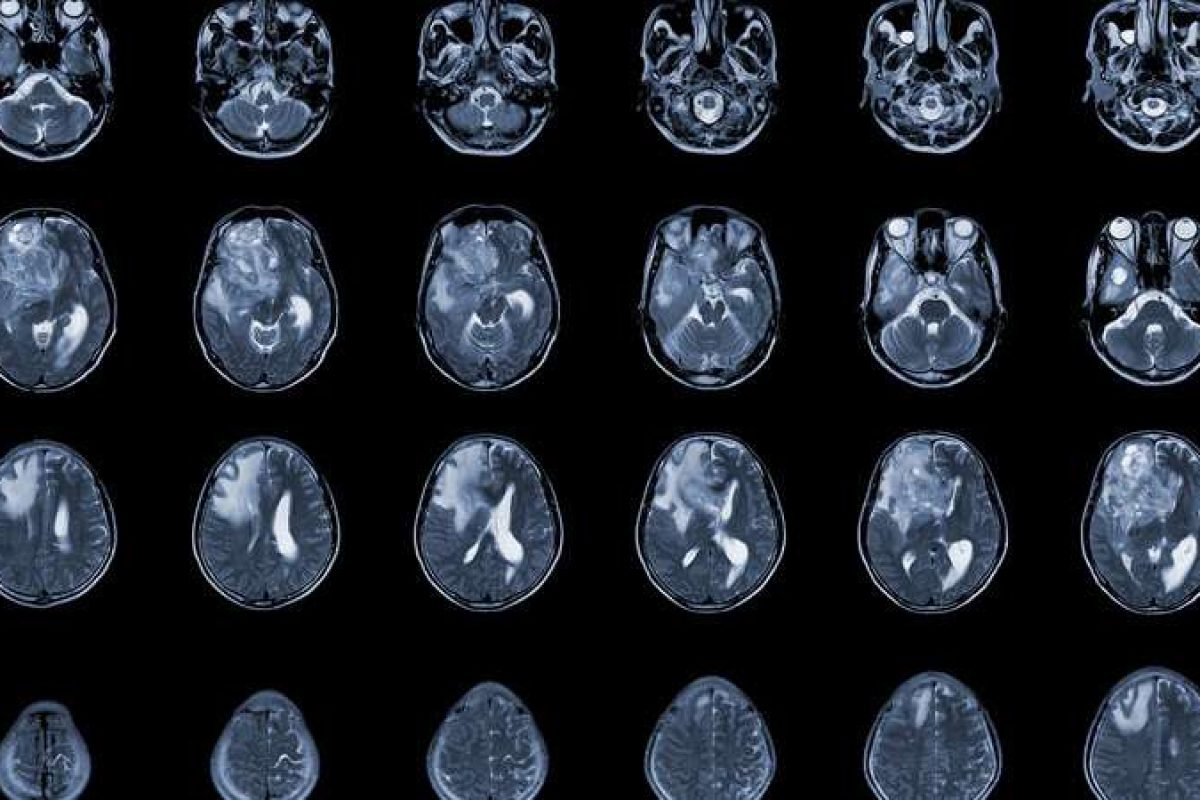 Drug Discovery World tweet media