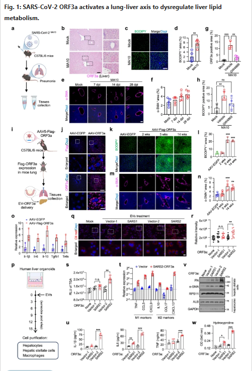 HarrySpoelstra's tweet photo. Exosomal ORF3a mediates lung-liver axis to dysregulate hepatic lipid metabolism in mild COVID-19

🚨Mild COVID doesn’t “just go away.”

This new and very interesting Chinees study illustrates:

SARS-CoV-2 turns your lungs into a factory that ships ORF3a protein via exosomes straight to your liver.
No virus in the liver, yet it triggers massive fat buildup, inflammation, and early fibrosis.

Is this  why so many people gain stubborn weight after even “mild” infection? SEMAGLUTIDE?

Study:
➡️ Mild COVID-19 causes liver dysfunction in 52.6% of patients (elevated ALT, AST, GGT) without direct viral infection of the liver,

➡️SARS-CoV-2 accessory protein ORF3a is packaged into exosomes by infected lung cells and systemically delivered to the liver,

➡️In hepatocytes, ORF3a binds Vps39 (HOPS complex), blocking autophagosome-lysosome fusion and causing massive lipid-droplet accumulation, steatosis, inflammation (↑IL-6, TNFα, IL-1β), macrophage polarization, and HSC-driven mild fibrosis,

➡️Findings confirmed in mouse mild-infection and lung-specific ORF3a models, plus human pluripotent stem cell-derived liver organoids,

➡️Exosome inhibitor GW4869 abolishes hepatic ORF3a delivery and damage,

(GW4869 is commercially available, but only as a laboratory research chemical. It is not yet an approved drug for human use or consumption)

➡️SARS-CoV-2 ORF3a is more potent than SARS-CoV ORF3a, and the effect is lost in the Beta variant (S171L mutation).

➡️Mild COVID-19 silently weaponizes lung-derived exosomal ORF3a to reprogram the liver into a lipid-storing, inflamed, fibrotic organ, proving AGAIN, that “mild” infection is never harmless

‼️So, thinking out loud, this may indicate that even mild COVID-19 could induce a Long COVID phenotype, effectively reprogramming the liver into an inflamed, fat-trapping organ.

Remarkably, GLP-1 receptor agonists like semaglutide (Ozempic/Wegovy) address this exact metabolic disruption head-on.

They might even reverse the liver damage, dropping the weight, and slashing inflammation.

This is another reason why they deserve the growing attention as a promising avenue in ongoing trials.

IMPORTANT REMINDER: “Mild” was never mild!
#AvoidSars2 #AvoidReinfections
https://t.co/WOBUMWqlk3