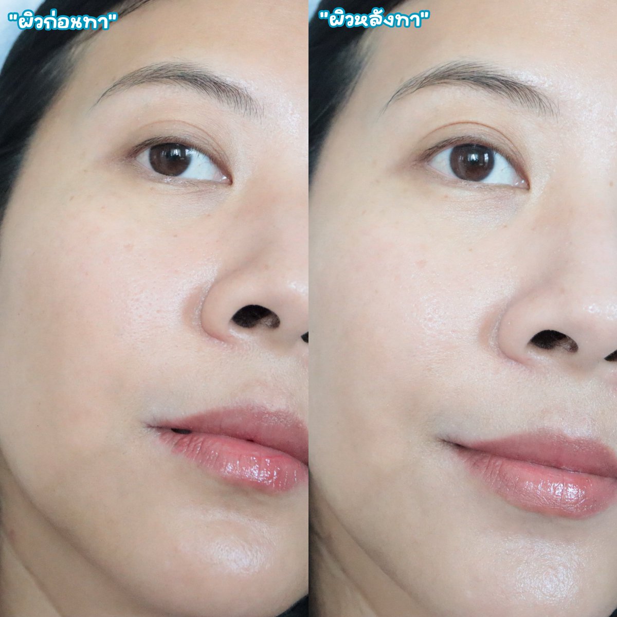 nursejk_'s tweet photo. ยกให้เป็นครีมสามัญประจำบ้านเลย CICAPLAST BAUME B5+  ของบ้าน La Roche-Posay เป็นมอยส์ที่ใครผิวแพ้ง่าย หรือเพิ่งทำหัตถการมาใช้ได้หมดเลย เนื้อครีมเข้มข้นมาก แต่เชื่อไหม ไม่เหนอะผิว อย่างเราผิวผสมเน้นทาก่อนนอน โบกไปเลย ผิวแข็งแรงขึ้นจริงๆ  ไม่แปลกใจที่นางขายดีจริงๆ https://t.co/HN4leIXUNh