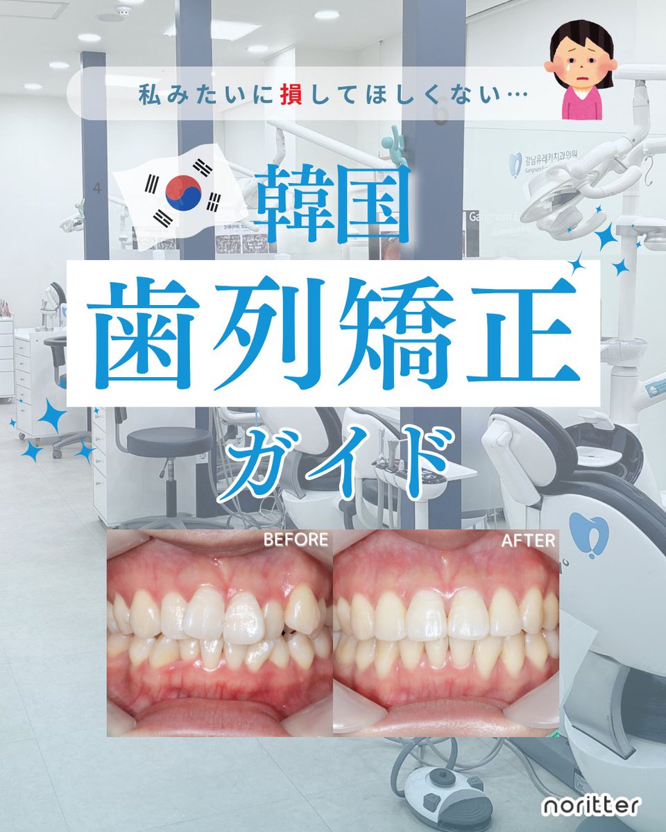 NoritterK's tweet photo. 日本で歯列矯正って月1~2回ペースで約2年半通院、
治療費も100万円���えって珍しくないよね🥺

それに対して韓国歯科だと
✔︎ 少ない通院回数で通える場合もある
✔︎ 約290万ウォン〜の矯正メニューもある
ってかなり差がある🫨

最近は韓国旅行のタイミングで矯正相談する日本人も増えてるよ~✈️🇰🇷

今回は、
✔︎ 矯正の種類の違い・自分に合う方法
✔︎ 実際の通院の流れ
まで分かりやすくまとめてみたよ✍️💫

noritterおすすめ歯科で聞いた内容をもとにしてるから信頼できる🫶🏻

限定特典もあるから、ぜひ���存して見返してね🌟