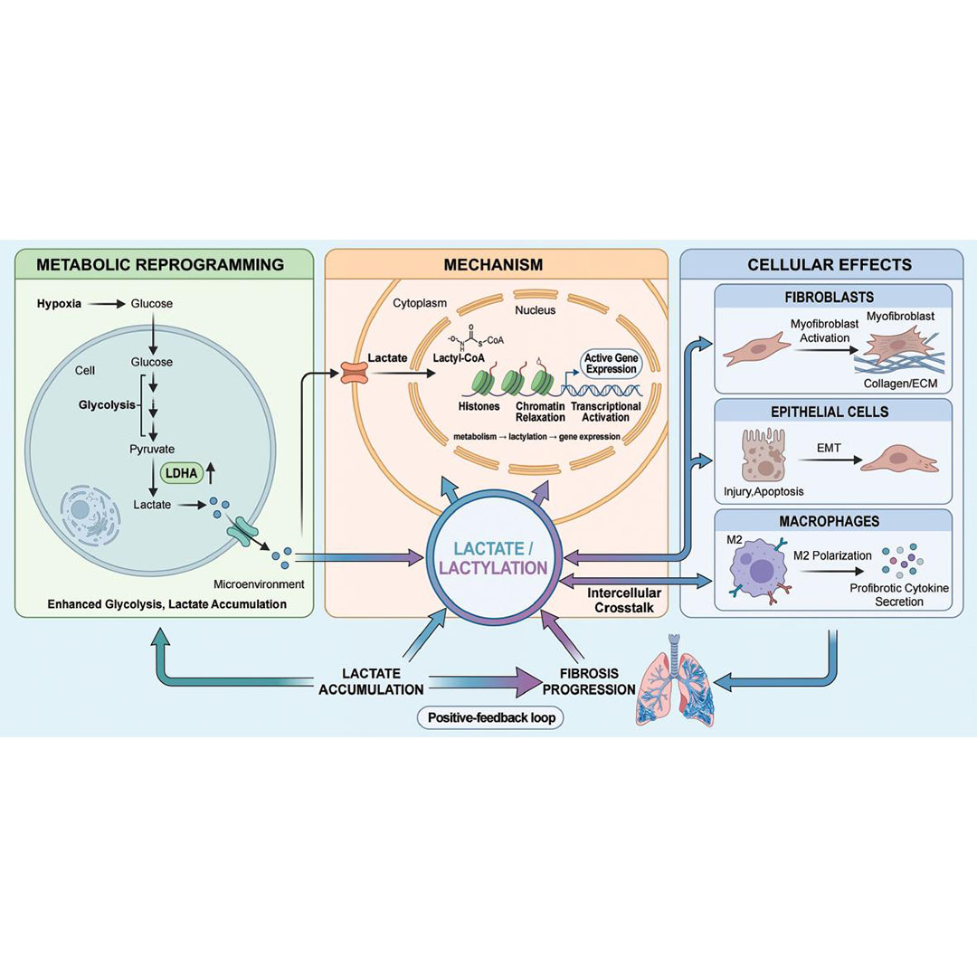 JournalBio's tweet photo. This review identifies #Lactylation as a key bridge between #MetabolicReprogramming and #fibrotic phenotypes in #PulmonaryFibrosis, highlighting its #translational potential as a novel #therapeutic target. #OpenAccess: https://t.co/jKRzjzKawR https://t.co/qYKbo2YABT