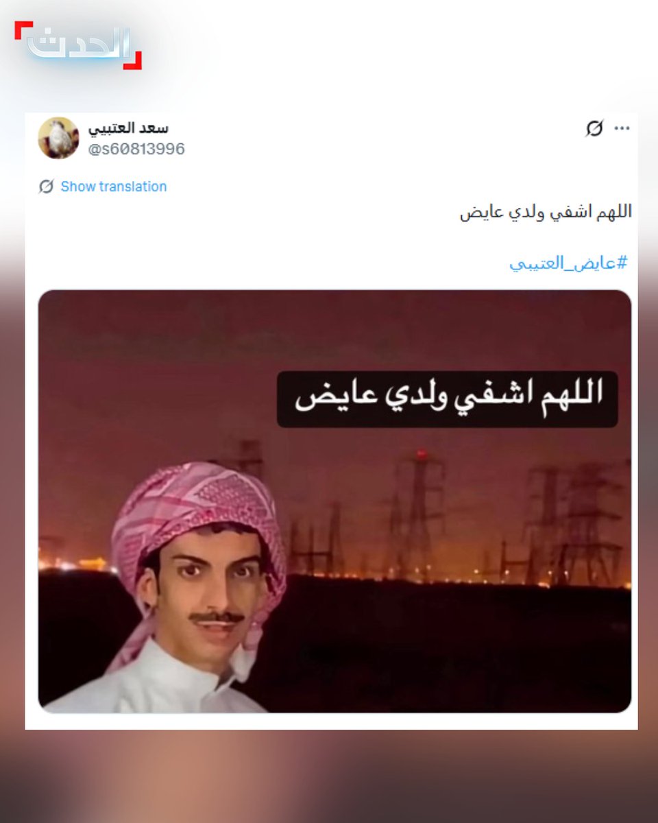 AlHadath's tweet photo. ما زال يكافح من أجل الحياة في العناية المركزة.. تغريدة دعاء والد الشاب الكويتي عايض العتيبي لنجله الذي فقد ساقه جراء القصف الإيراني لمطار الكويت تلقّت تفاعلاً واسعاً في الخليج

🔴 تفاعل خليجي واسع مع تغريدة لوالد الشاب الكويتي عايض العتيبي يدعو له بالشفاء أثناء كفاحه للحياة في العناية المركزة

🔴 العتيبي فقد ساقه إثر بتر كامل جراء القصف الإيراني الذي استهدف مبنى الركاب بمطار الكويت بشكل مباشر

🔴 العتيبي موظف جمارك كان على رأس عمله بمبنى الركاب "T1" لحظة استهدافه المباشر بالهجوم الإيراني

🔴 الكشف الأولي لمستشفى الفروانية يسجل 38 إصابة متفاوتة، بينما تجاوز إجمالي المصابين رسمياً 63 شخصاً

🔴 الإصابات شملت 7 جنسيات وتنوعت بين الشظايا وبتر أطراف كحالة العتيبي والمقيم المصري ممدوح عبد العلي