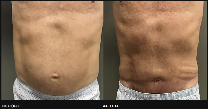 surgicaloasis's tweet photo. Cosmetic Procedures For Men. Full #CosmeticProceduresForMen are offered based on your specific needs. A tailored approach to help you achieve your aesthetic and functional goals. Need #CosmeticProcedureinOC ? Call #DrIraniha today. #OCMenCosmeticSurgery 
https://t.co/9gMkCltDlW https://t.co/cwYBwXoOU6