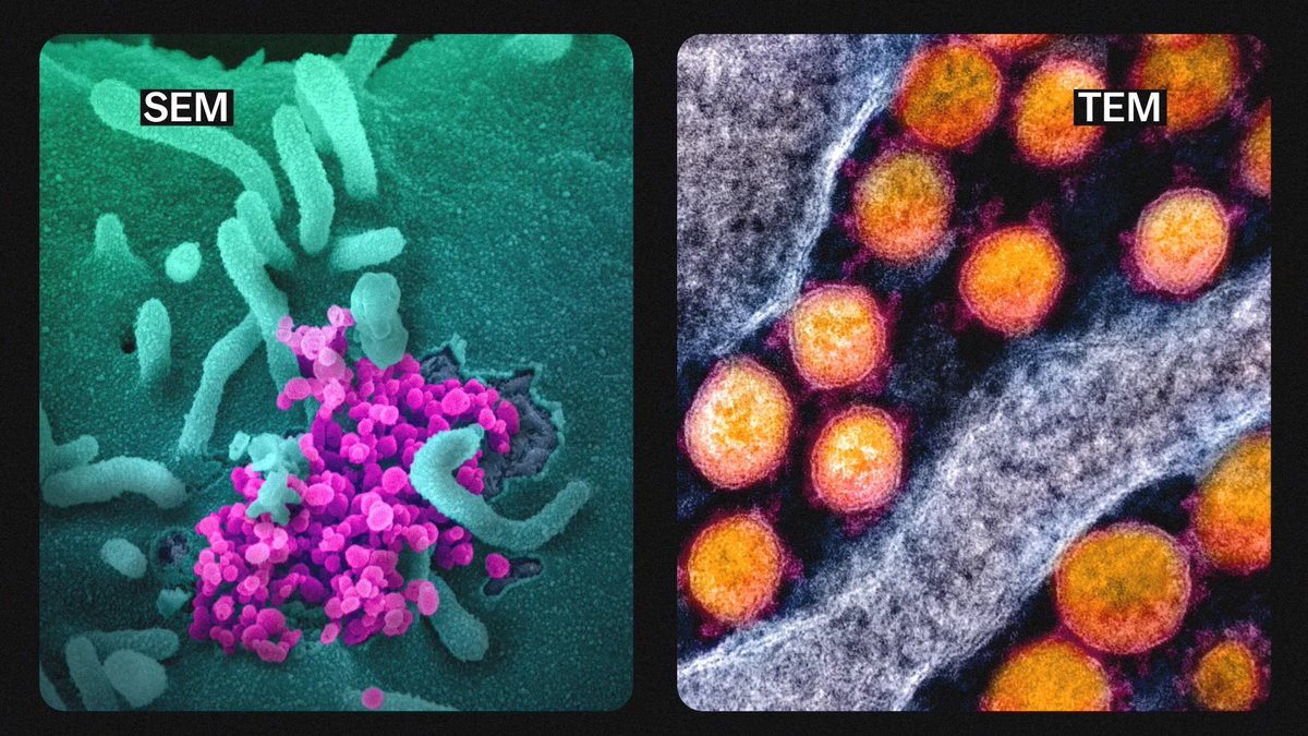 CyclicallyC's tweet photo. @KathySalad53513 It's not "supposed" to be anything.  It's the result of scanning and tunneling electron microscopy.

Unless you don't believe in things you can't see, in which case turn off your radio. https://t.co/DNoaCpXnkn