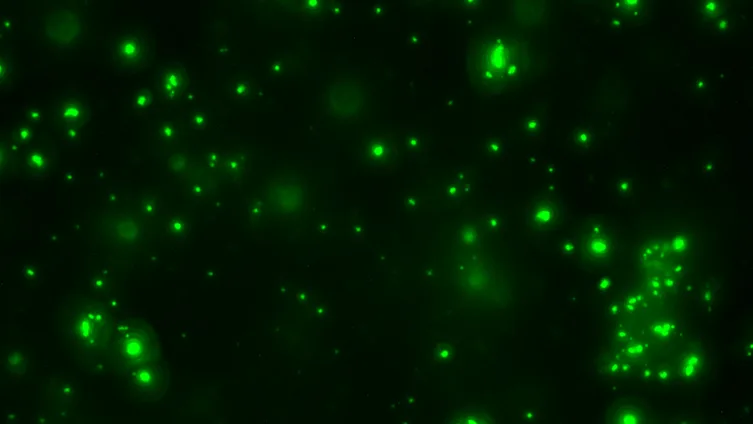 YaleNeuro tweet picture