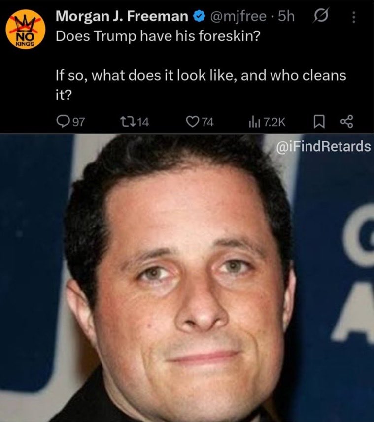 Rob14228677228's tweet photo. @mjfree This is what end stage TDS looks like https://t.co/KpjCRpfOrp