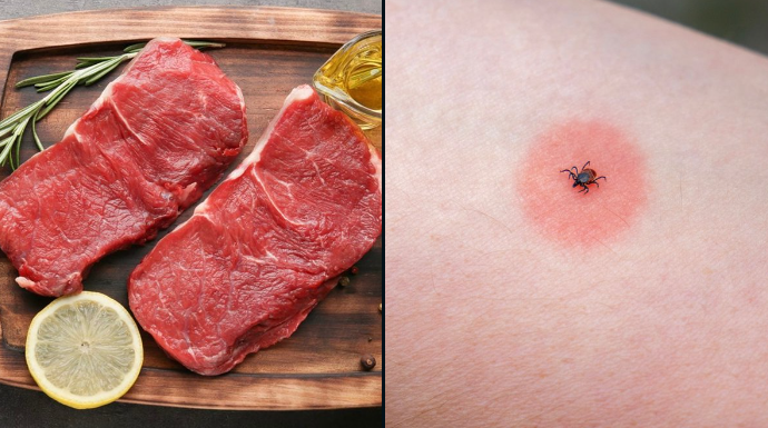 gotthetick's tweet photo. Scientists are facing criticism after suggesting that intentionally spreading a condition that causes meat allergies could be ethically justified. https://t.co/Hp0SaVgxZL