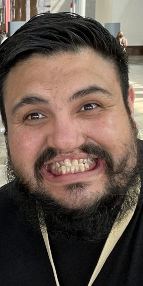 DrDhelizioso's tweet photo. Te puedes reír de la baja higiene personal del gangoso del bienestar @zorrotapatio y no te dice nada, pero no le digas que sale con un hombre porque de inmediato te bloquea 🤭 https://t.co/FPiMOM4wCJ