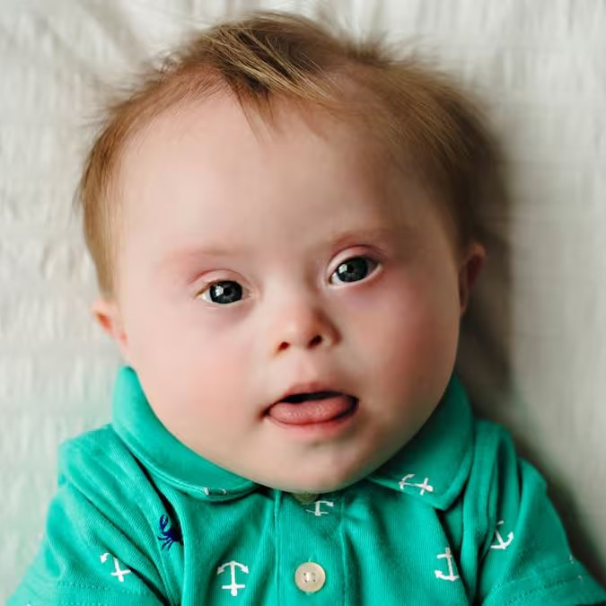 bralternativo_'s tweet photo. 🇺🇸👶🏻 O YouTuber Jesse Ridgway anuncia que ele e sua esposa decidiram ABORTAR seu filho ao saber que nasceria com Síndrome de Down.

A decisão foi divulgada por meio de um extenso comunicado nas plataformas oficiais do influenciador.

O caso gerou polêmica e polarização nas redes, muitos internautas e grupos de apoio a pessoas com deficiência expressaram forte rejeição.