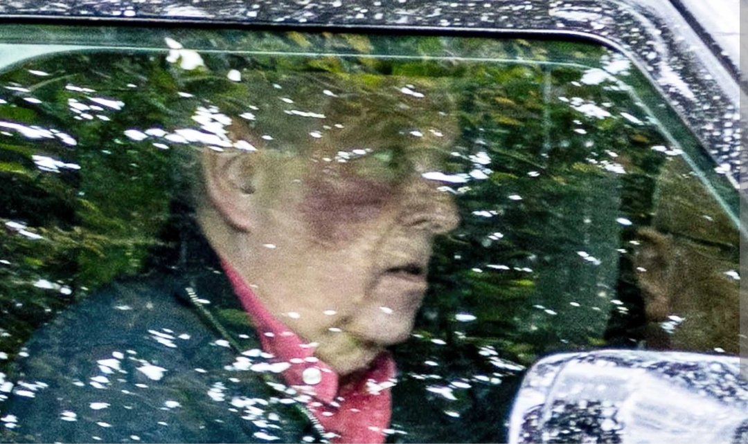 I_amMukhtar's tweet photo. Andrew Mountbatten-Windsor has been spotted driving with a large bruise on his face. https://t.co/0Pk1IahVnx