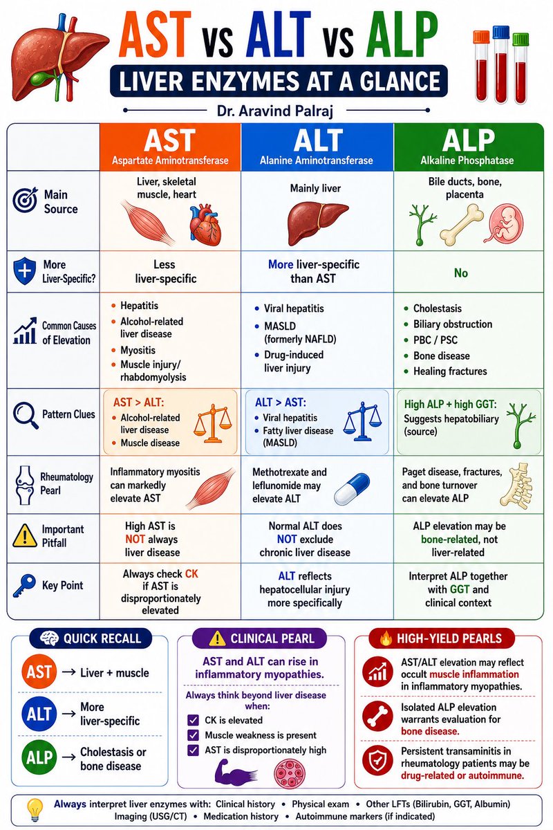 Rheumat_Aravind's tweet photo. 🧪 AST vs ALT vs ALP

Quick recall:

🟠 AST → Liver + muscle
🔵 ALT → More liver-specific
🟢 ALP → Cholestasis or bone disease

High-yield pearls:

• AST > ALT → alcohol liver disease OR muscle disease
• ALT > AST → viral hepatitis/MASLD
• High ALP + high GGT → hepatobiliary source likely

⚠️ Rheumatology pearl:
AST/ALT can rise in inflammatory myopathies.

Always check CK if AST is disproportionately elevated.

#MedTwitter #Rheumatology #Hepatology #Myositis #MedicalEducation #ClinicalPearls #AST #ALT #ALP #FOAMed