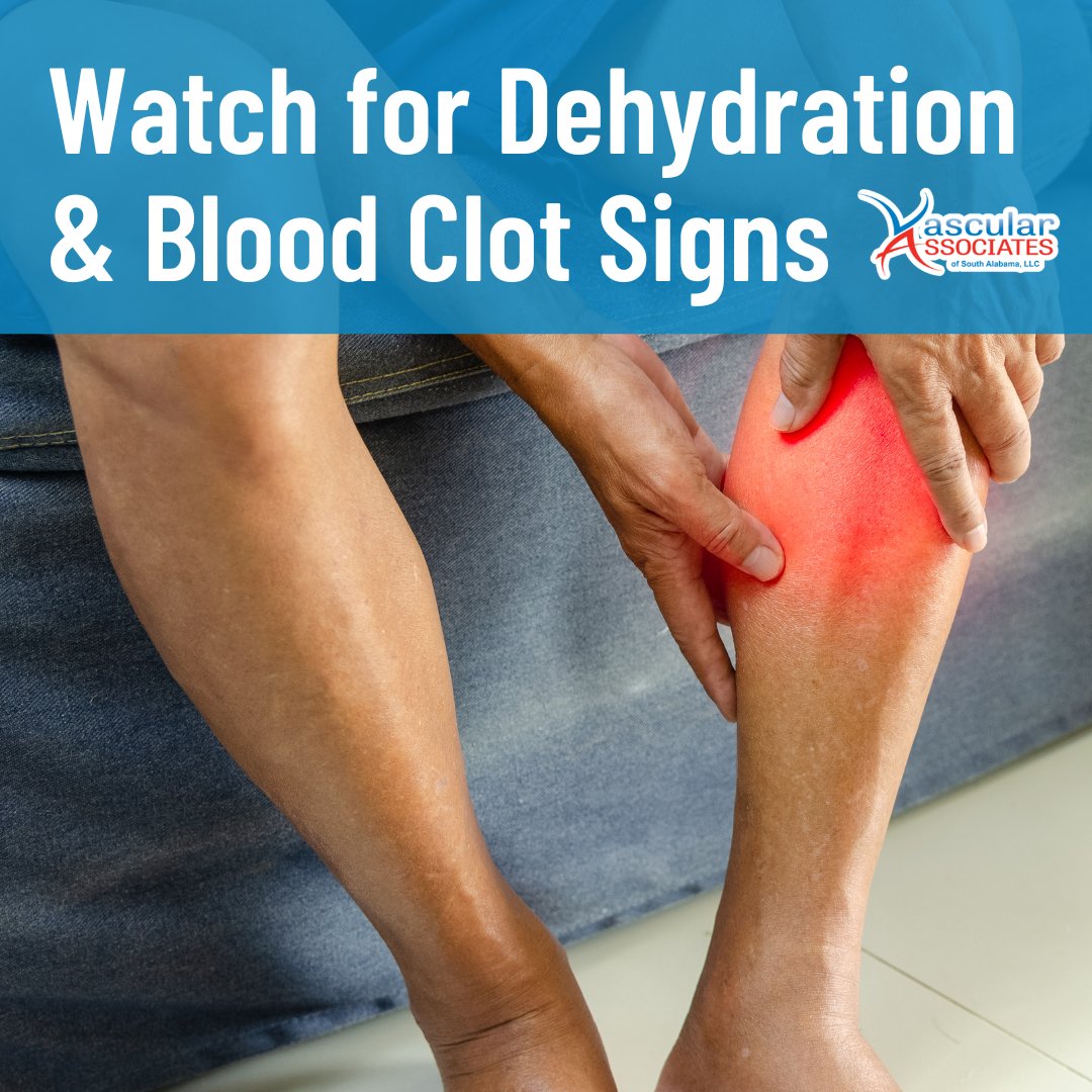 of_vascular's tweet photo. If you experience leg pain, swelling, redness, or a feeling of warmth, don’t dismiss it as heat-related. 🦵 These could be signs of a clot or vascular complication and should be evaluated immediately. 

☎️ 251-410-8272

#Vascular #SouthAlabama https://t.co/ArYPIMbNpZ