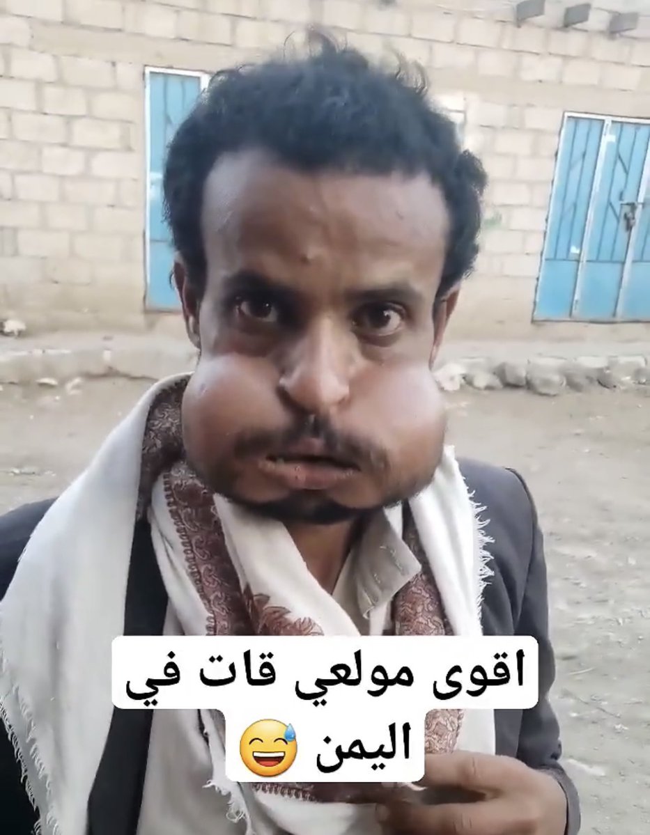 مسفر قضعان العايذي القحطاني tweet media