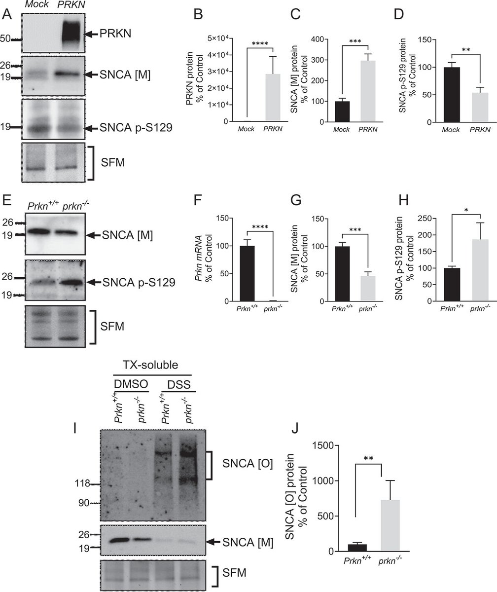 ScienceofPD's tweet photo. New research reports that "PRKN controls both direct &amp; indirect (GBA1-dependent) transcriptional regulation of SNCA" in cellular, mice models &amp; #Parkinsons-affected brains
https://t.co/pwg6lz8mmo https://t.co/RKhcSJEgwY