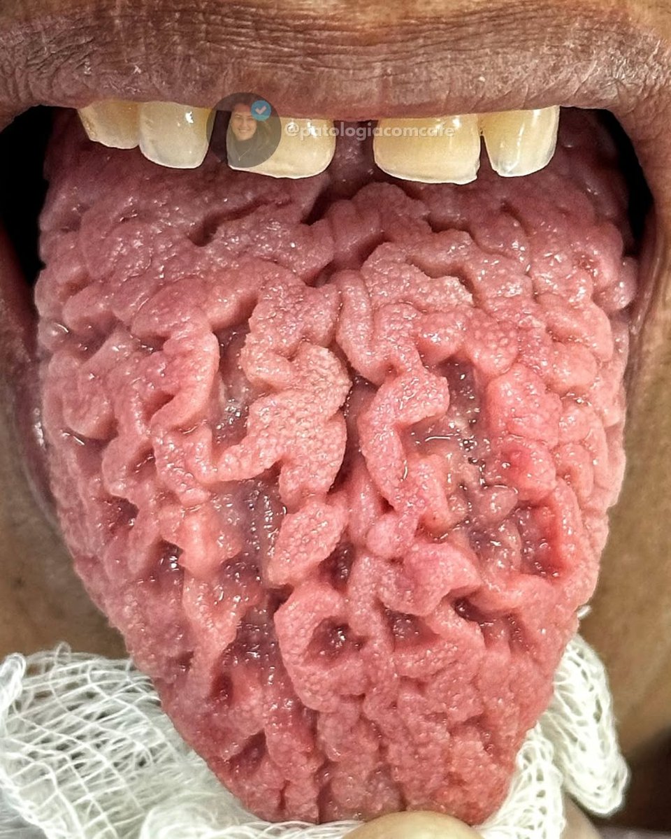 gainknowIIedge's tweet photo. Can anyone guess the name of this condition without Googling? 🤯🤯 https://t.co/VyfWWhVFxx