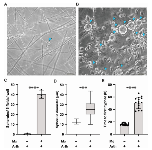 ASMicrobiology's tweet photo. When Coccidioides spores are inhaled, they transform into a pathogenic form that allows the fungus to spread throughout the body and cause disease. New research in #mBio shows that macrophage phagocytosis of Coccidioides promotes this differentiation. https://t.co/J8C9ghQx3L https://t.co/yirbTtleh6