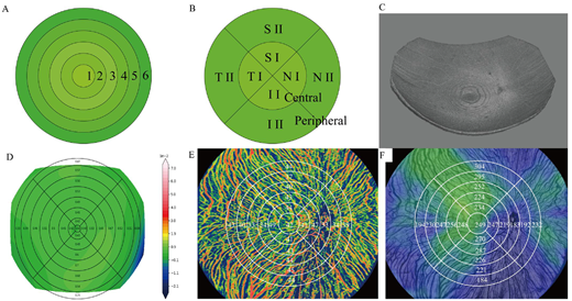 ARVOtvst's tweet photo. Rui Li et al. from Wuhan University of Science and Technology investigate the relationship between RC and choroidal structural and perfusion-density metrics in high myopia. 
https://t.co/sGKo0TEztB https://t.co/V9sDfQ5I9U