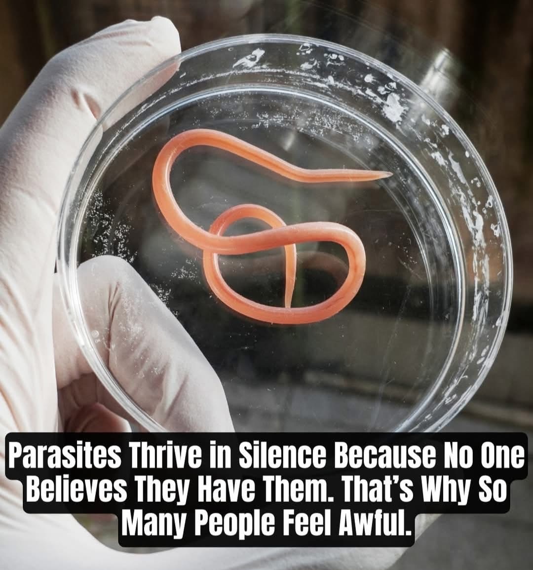 DrNicholasG_'s tweet photo. Parasite 🪱in the Gut is called IBS

Parasite 🪱 in the Liver is called Hepatitis

Parasite 🪱 in the Blood is called Anemia

Parasite 🪱 in the Brain is called MS

Parasite 🪱 in the Hands is called RA

Parasite 🪱in the Skin is called Rash
#detox #ivermectin #parasite https://t.co/ckiu6xPaUz
