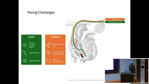 EPLive2's tweet photo. 🎬 Case Review at #EPLive2026 | Dr. Robert Canby presents an EBR WiSE-CRT implant. Wireless LV endocardial pacing — no CS lead. The coronary sinus isn't the only route to cardiac resynchronization anymore. 🔋🫀 Does WiSE-CRT change your approach to CRT non-responders? #EBR #WiSECRT #CRT #HeartFailure #EPeeps