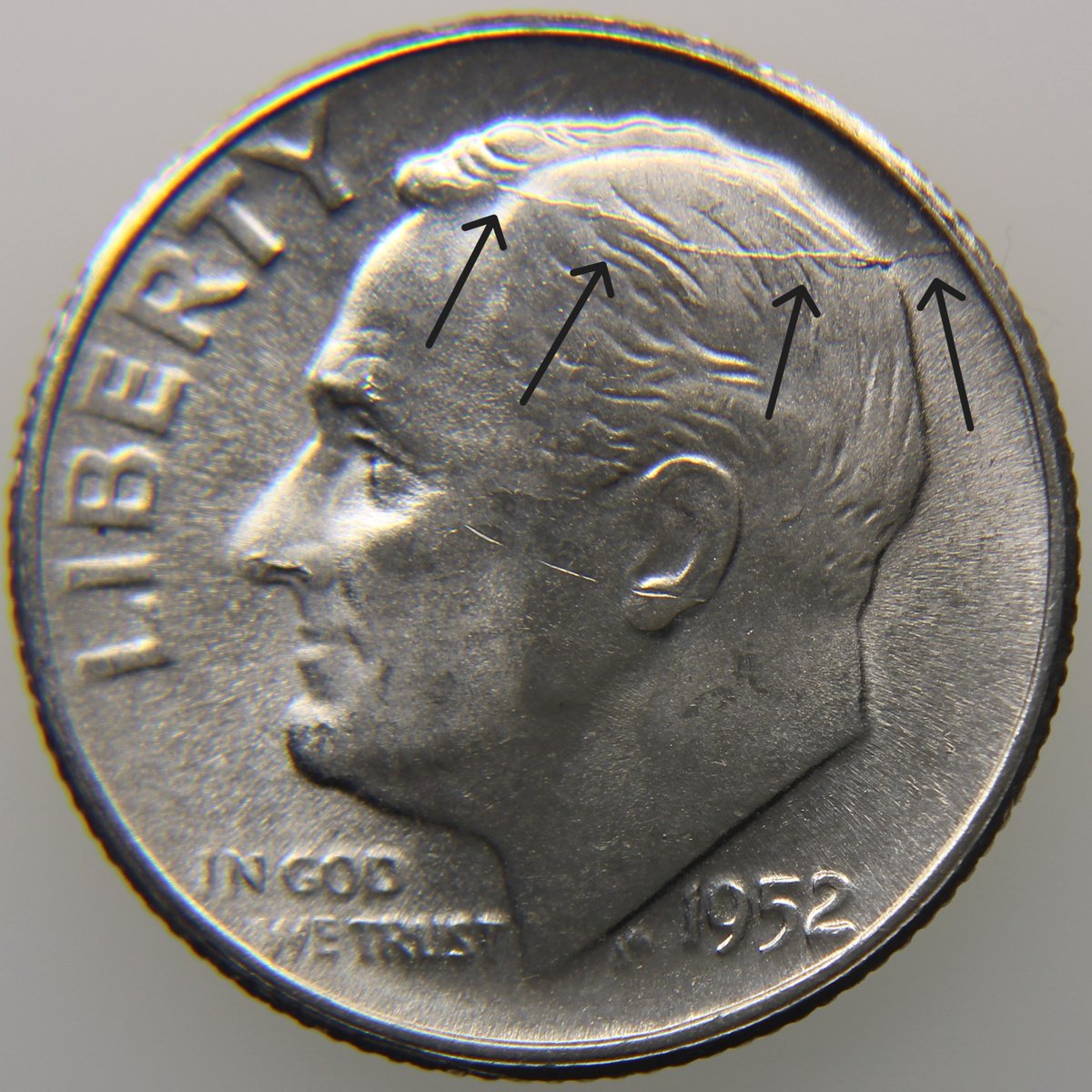 numisdex's tweet photo. Roosevelt grew horns.

This 1952 dime has die cracks extending right off the back of his head — collectors call it a "spiked head." The main crack runs from the rim across Roosevelt's skull.

Dies endure 35-150 tons of force per strike, hundreds of thousands of times. Eventually they crack. Metal gets forced into those fractures during striking, leaving raised lines on the finished coin.

 When cracks radiate from the top of a portrait, you get this horned look that's visible without magnification.

  Still in my collection.