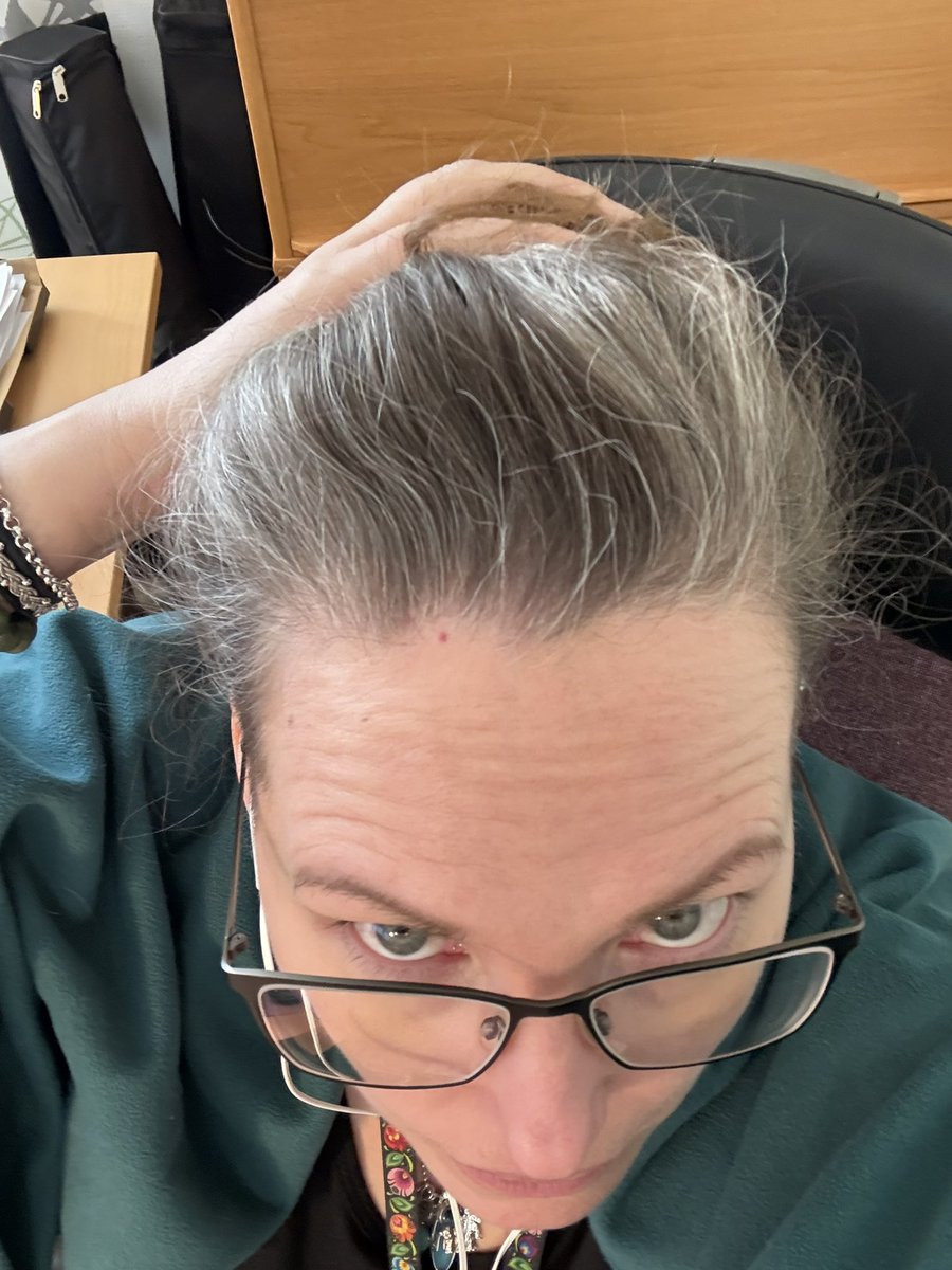 jeyhawk's tweet photo. @andlikesuns I’m growing it out natural which creates a hilarious two tone effect. (I took the first pic at work where the overhead lights truly showcase the white.) https://t.co/yhFUXs7Ue4
