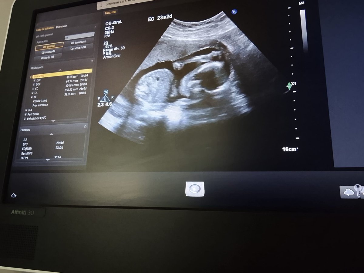 derechoavivir's tweet photo. Bebé salvado!❤️
Una de las mamas con la que hablamos hace semanas me manda una ecografía ya de 23 semanas!!

Hasta las 22 semanas hacen abortos haciendo en el abortorio un diagnóstico de trastorno mental a la madre. https://t.co/qVZD6e4Ye5