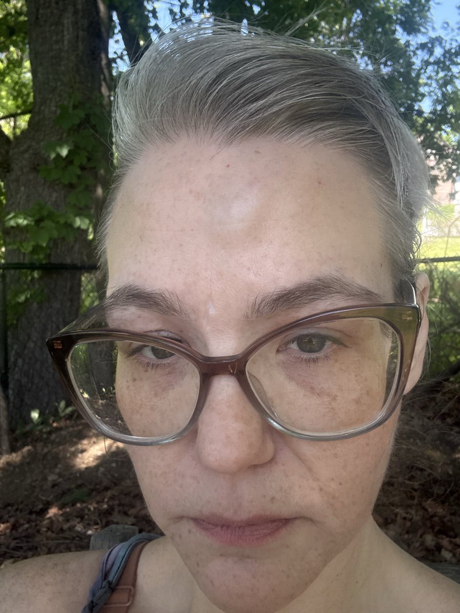 bees_bertie's tweet photo. Incredibly lost💔 Injured again @ work; completely drained, physically&amp;emotionally. Trying to stay strong, but this road has felt so cloudy &amp; heavy lately, with only small glimpses of light. 🌧️ My cup feels empty, how can I keep pouring into others with so little left in me. 🥀🫶🏼 https://t.co/8af7sX5to4