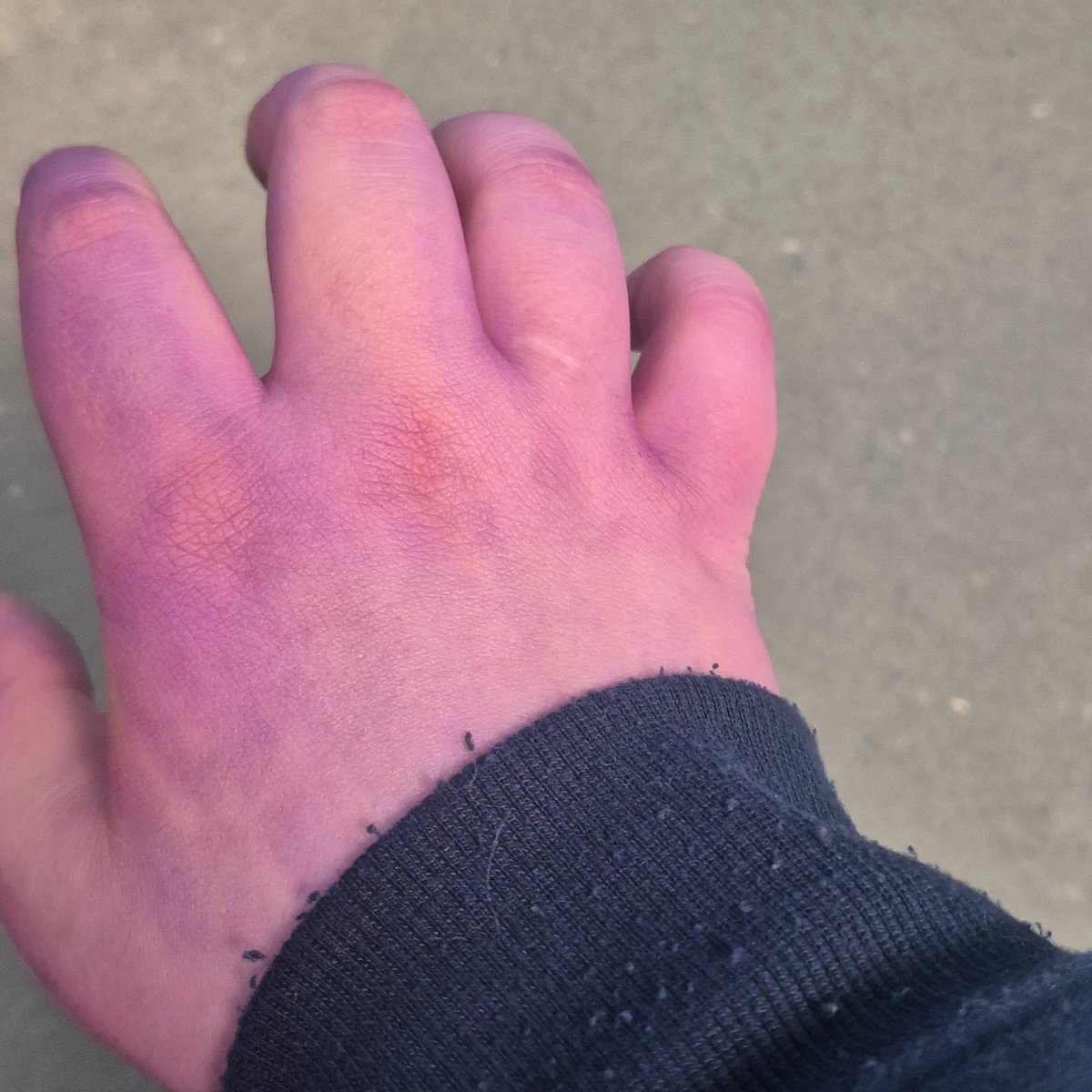 finnooss's tweet photo. Should I tan this summer yes or nooo? This is what just my hands look like noowww. idkkkkkkk should iiiiii? https://t.co/3Ttnr6lmVz