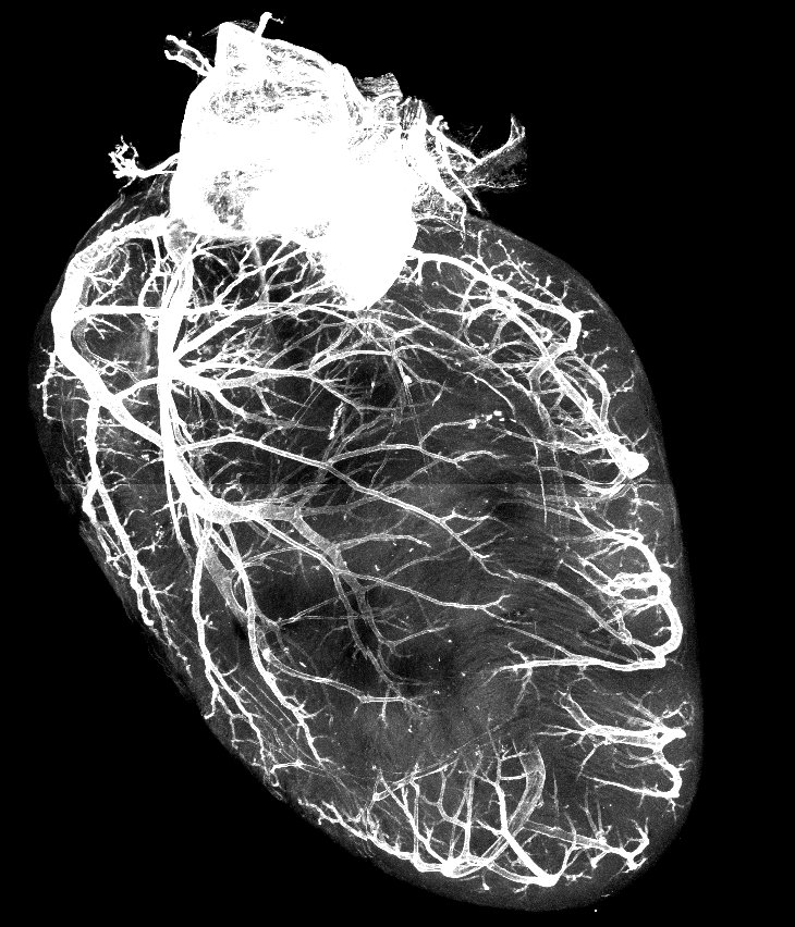 jameszsci's tweet photo. Looking to join a collaborative team studying coronary artery development? Love taking pretty microscope images? The Red-Horse lab (@hhmi_science/@Stanford) is hiring for a senior scientist to research coronary &amp; collateral artery development apply below!:
https://t.co/sVvxNFEXPo https://t.co/YPZf0TxVOD