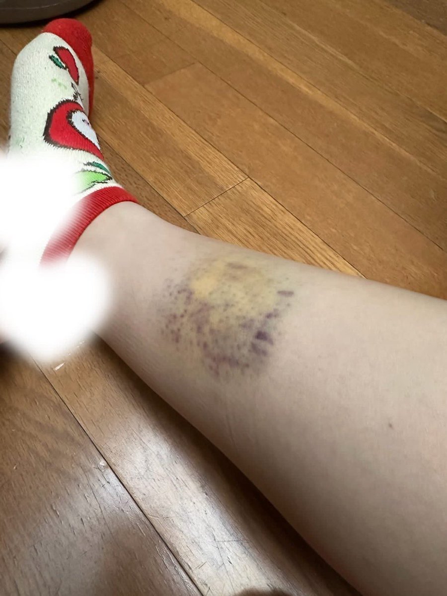 orihara_bakuro's tweet photo. 【第三弾】

グループダンディー　CANDY 湊叶迴

説明
女性に蹴りを入れて怪我をさせる。
被害者二人目。 https://t.co/n0L41TYOoz