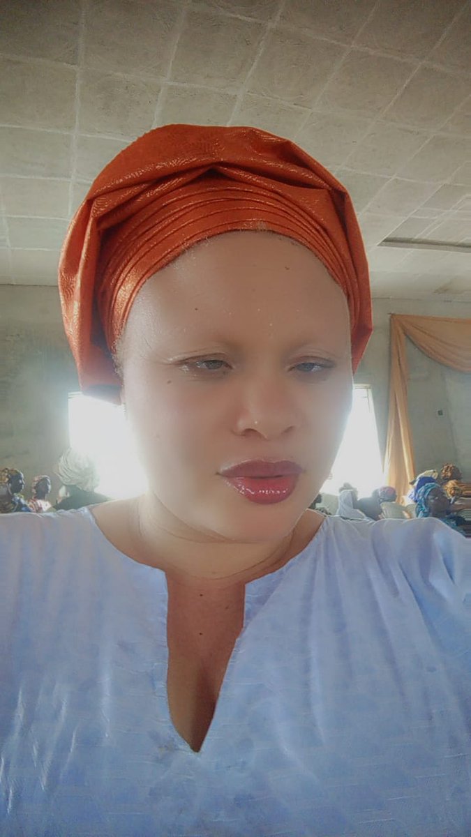 Shiny Sisters(Albinism is beautiful)😍 tweet media