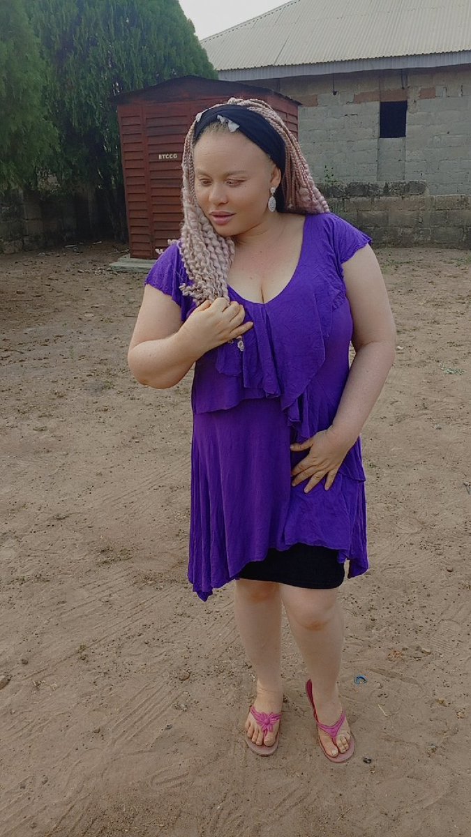Shiny Sisters(Albinism is beautiful)😍 tweet media