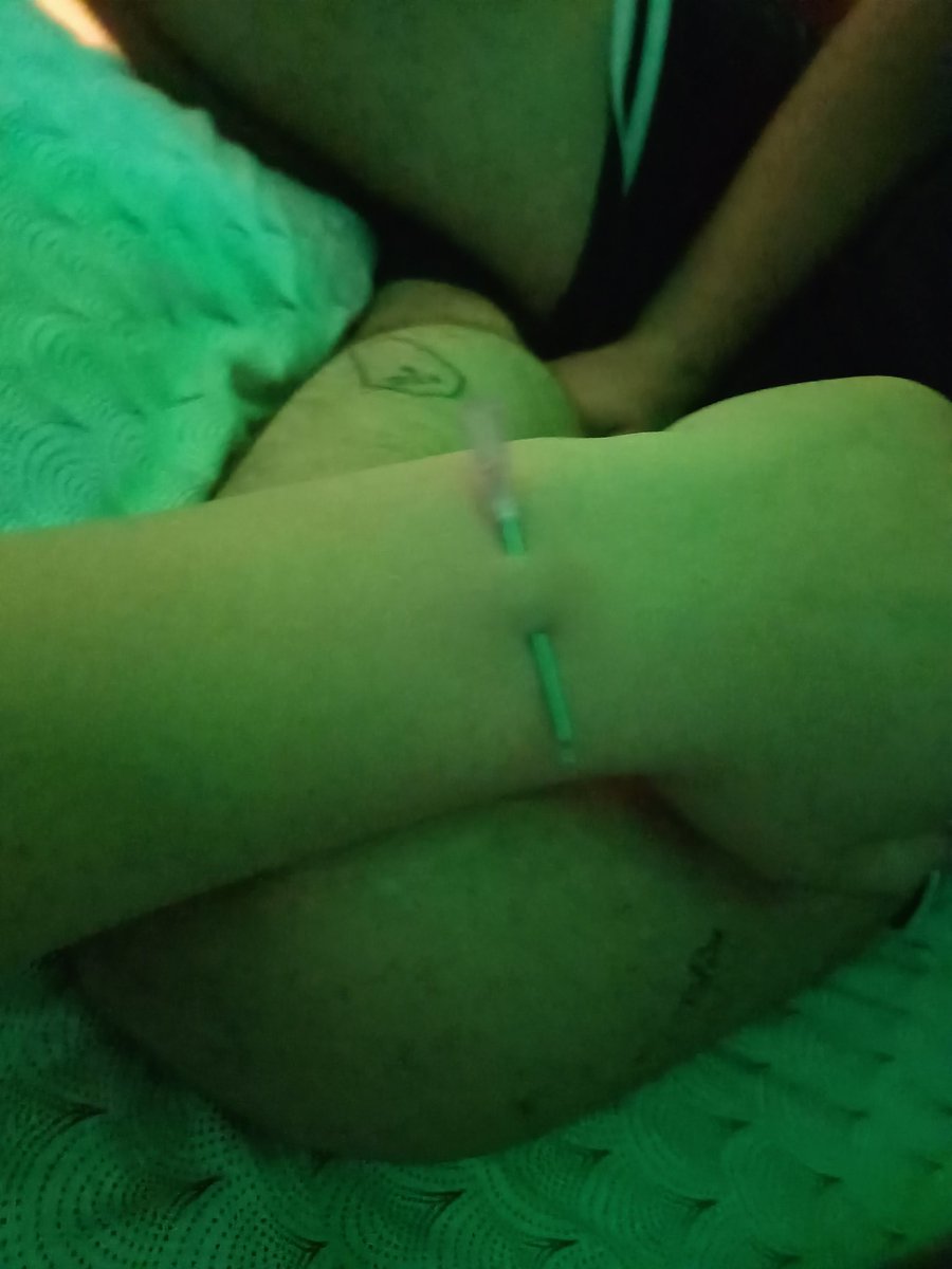 Fall_of_Artemis's tweet photo. someone punctured a puppy
 υ˶˃ ﻌ ˂˶υ
#ts #trans #nsfw #nsfwtwt #transexual #transfem #transgirl #tgirl #gothgirl #uwu #egirl #nsfwtwtًًً #femboy #puppygirl #petplay #puppy #t4t #lesbian #alt #mutt #piercingplay #needles https://t.co/3xhv3e4xTh