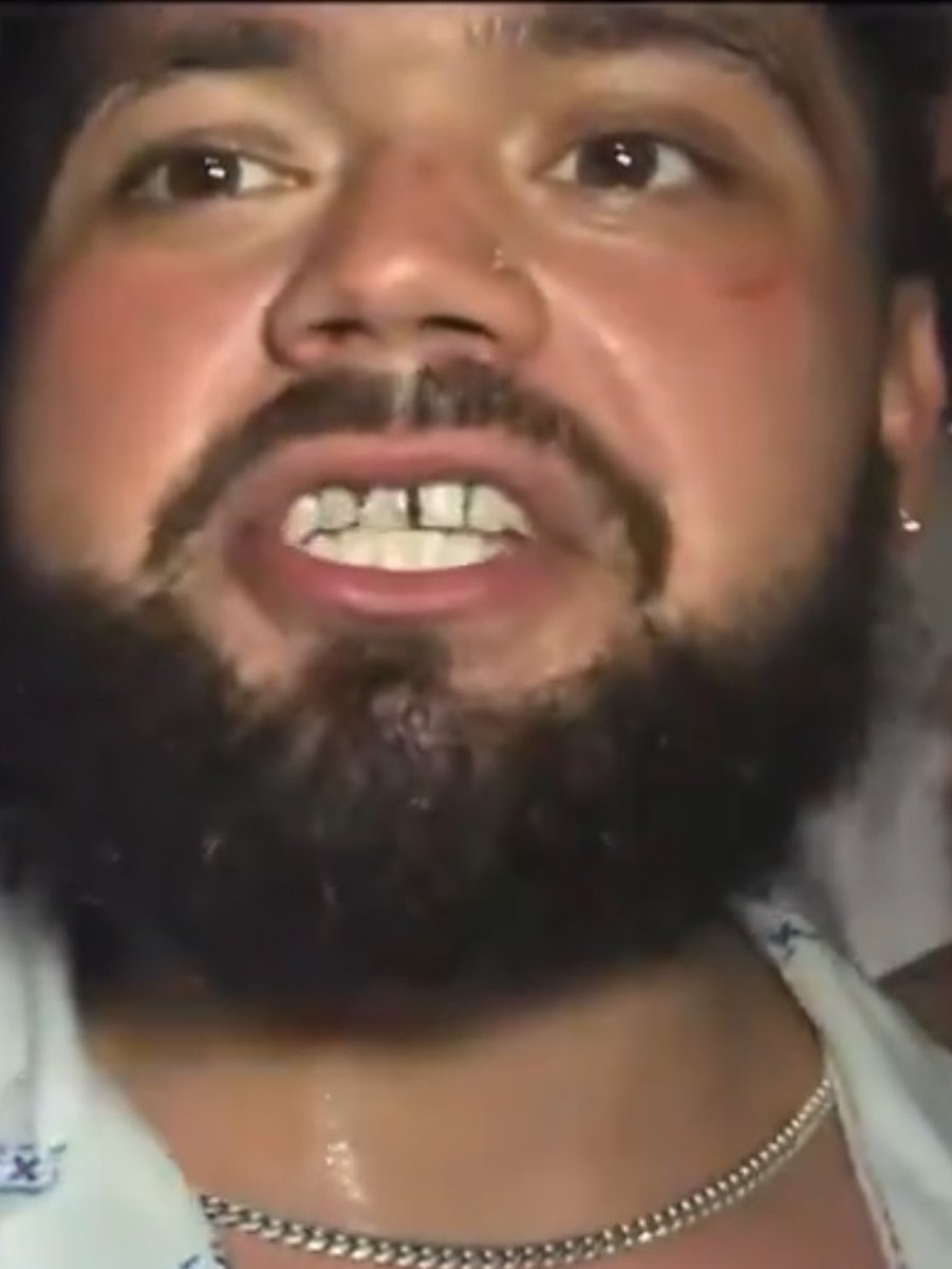 SlightProblm's tweet photo. @parti_king @isaac_cf7 Bro literally has shit between his teeth 😷💩🤮🤢 https://t.co/L0XwLu3wsV