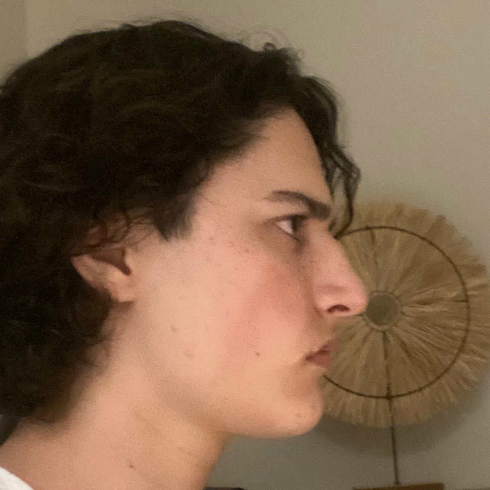 OscarPatel's tweet photo. Everyone could have a defined jawline if they understood Myofunctional Therapy. 

It is honestly so easy. 

(genuinely)

But everyone's too busy believing that it is "genetics" or they need surgery to fix it. 

When all that is required is for them to keep their mouth shut (literally)

Mouth breathing is one of the many detrimental parafunctional habits that recede our jaw, collapse the facial structure and make us unattractive.

Here are some habits that you need to correct to improve your face:

-duck feet
-poor posture
-inactive lifestyle
-sleeping on your back
-suckling food and water
-improper tongue posture
-asymmetrical chewing and mewing
-mouth breathing (look at Ronaldinho)

Fix these ☝️ 

To get results like these 👇