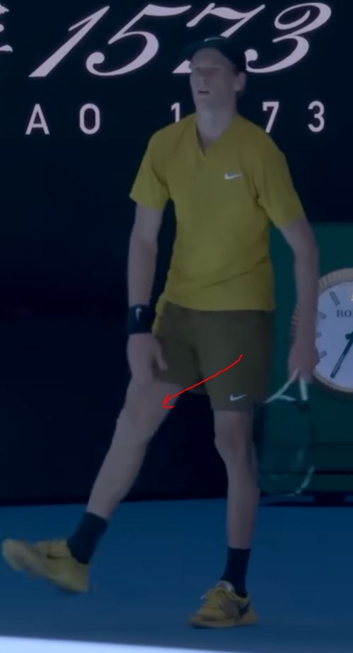 TeslaAC_'s tweet photo. @TennisChannel Cramping, we've seen it before. 

Photo A: Can see a large indent in his right quad (search: quad cramp).
Photo B: He proceeds to massage his quad with his elbow whilst he's on the bench.
Photo C: Can see him have the same cramp in his match against Spizzirri at AO26. https://t.co/RIM0fTPIw5