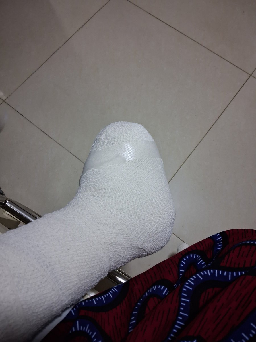 The Lady With No Toes tweet media