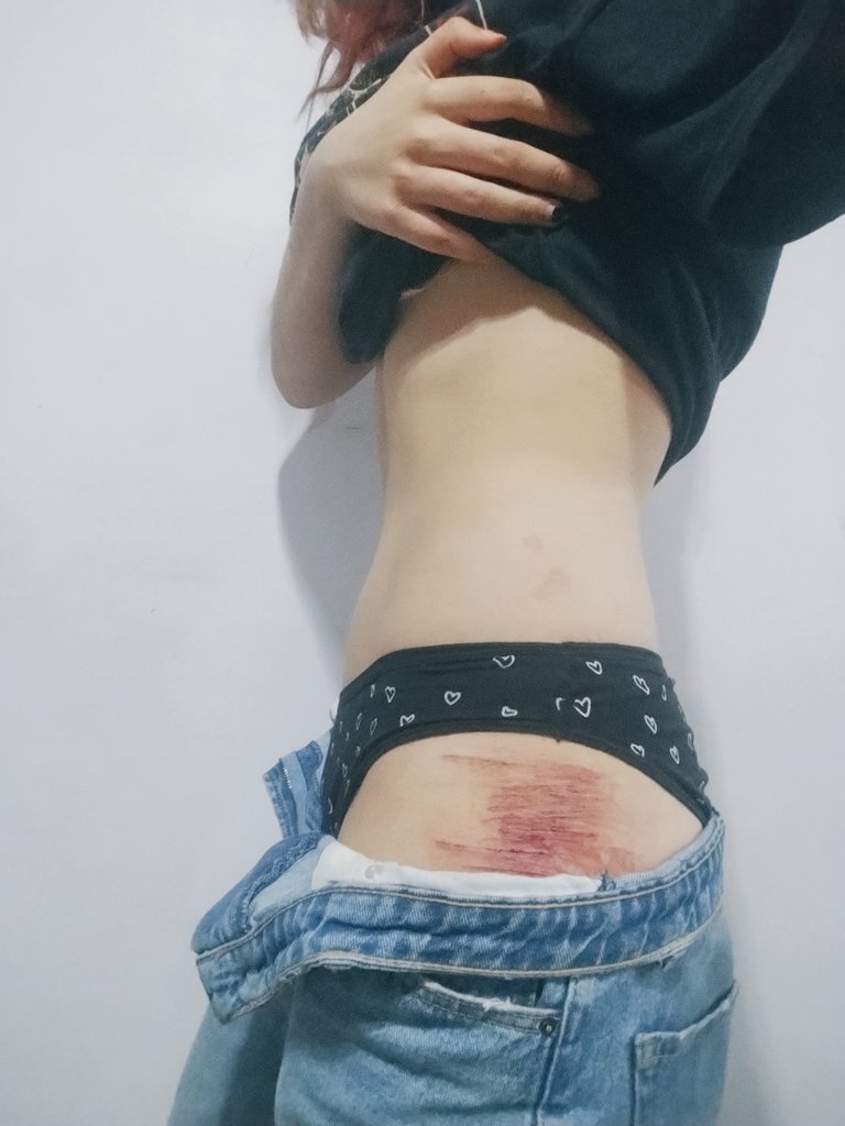 __Noctyx_'s tweet photo. Voy a empezar a hacer bc pq nmms q gorda de mrda soy 😭 nececito q me hagan bullying o algo a ver si así bajo (ando de q super mal hoy pq comí demasiado disculpen) #edtwt #shedtwt #shtwt #sh https://t.co/jfwSOiSL6P