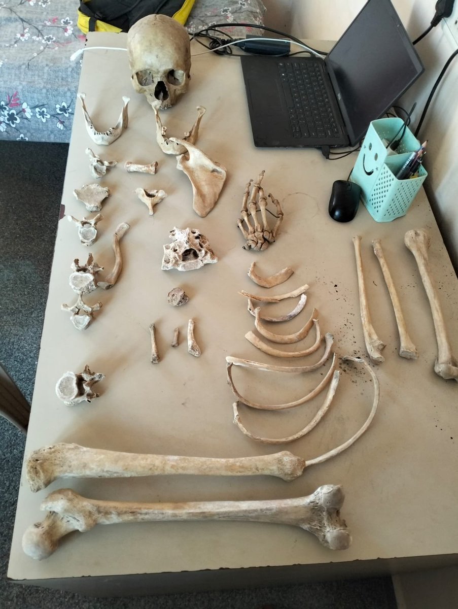 its_faiz_here's tweet photo. "Me trying to lock in for exams after pulling three consecutive all-nighters. 💀📚 #MedStudent #Anatomy #FinalsWeek #StudyGram" https://t.co/fP83gLCPBK